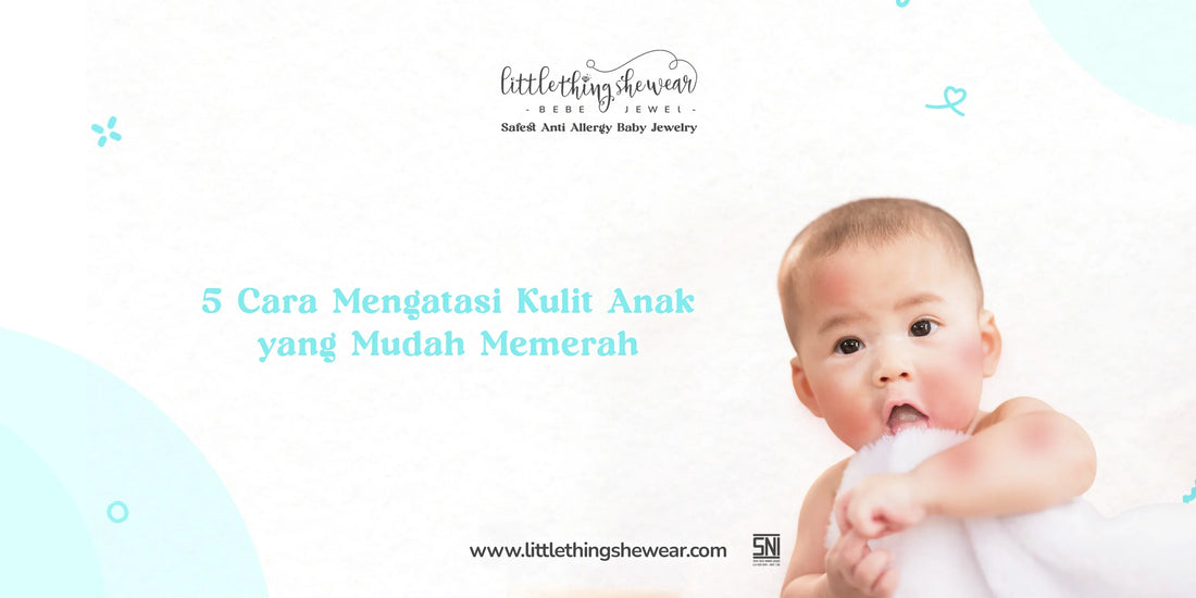 cara mengatasi kulit anak yang mudah memerah