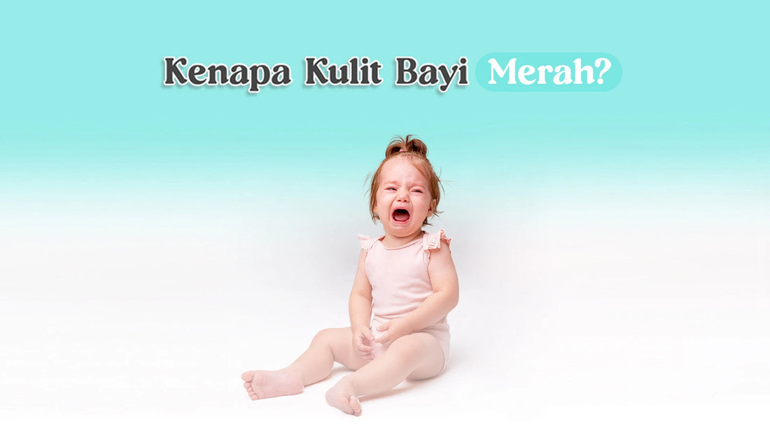 kenapa kulit bayi merah